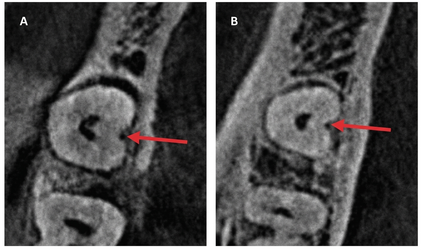 십정동 치과 C형 근관 CBCT 단면 해부구조 이미지