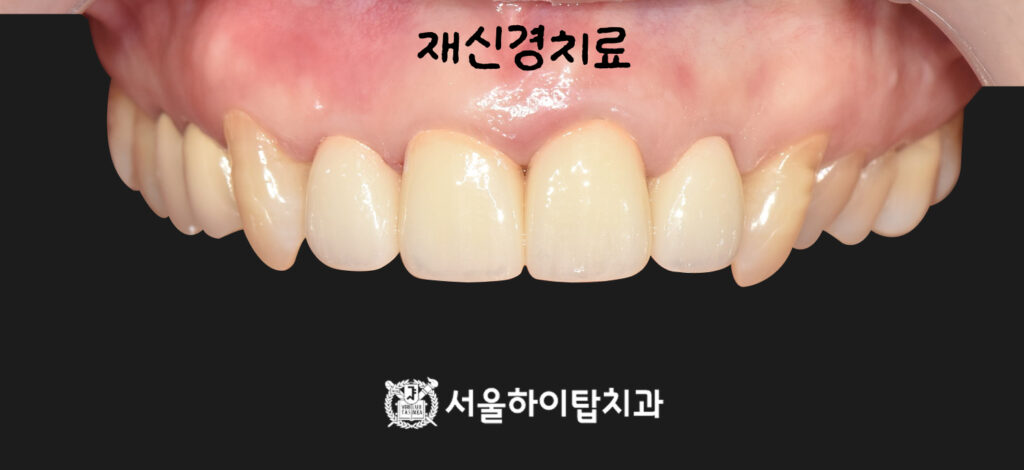 서울하이탑치과